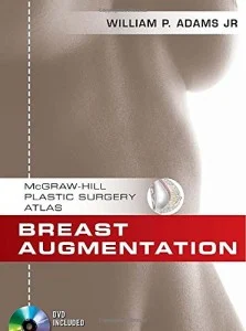 Breast Augmentation (McGraw-Hill Plastic Surgery Atlas) (ORIGINAL PDF from Publisher)