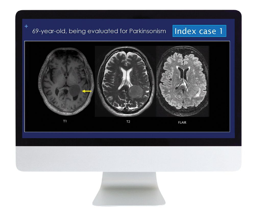 Case Review of Neuroradiology