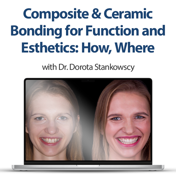 Composite & Ceramic Bonding for Function and Esthetics: How, Where & Why (2023)