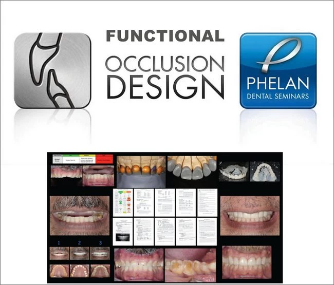 Functional Occlusion Design Dental Seminars (Full Bonus Package)