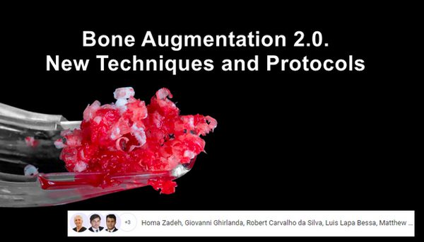 OHI-S Bone Augmentation 2.0, New Techniques and Protocols (Training in Implantology)