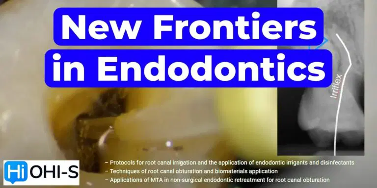 OHI-S New Frontiers in Endodontics