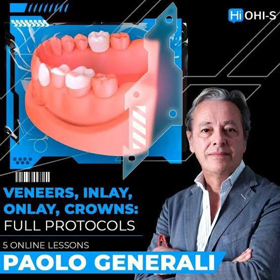 OHI-S Veneers, inlay, onlay, crowns full protocols (Videos)