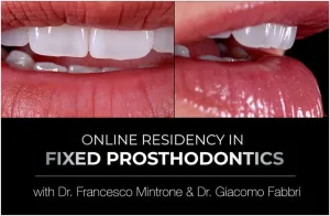 Online Residency Program in Fixed Prosthodontics: Esthetic and Functional Rehabilitation of Natural Teeth