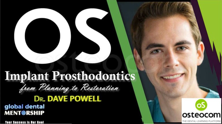 Osteocom Implant Prosthodontics, from Planning to Restoration – David Powell