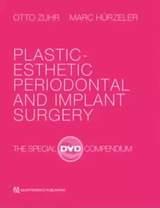 Plastic-Esthetic Periodontal and Implant Surgery: The Special DVD Compendium