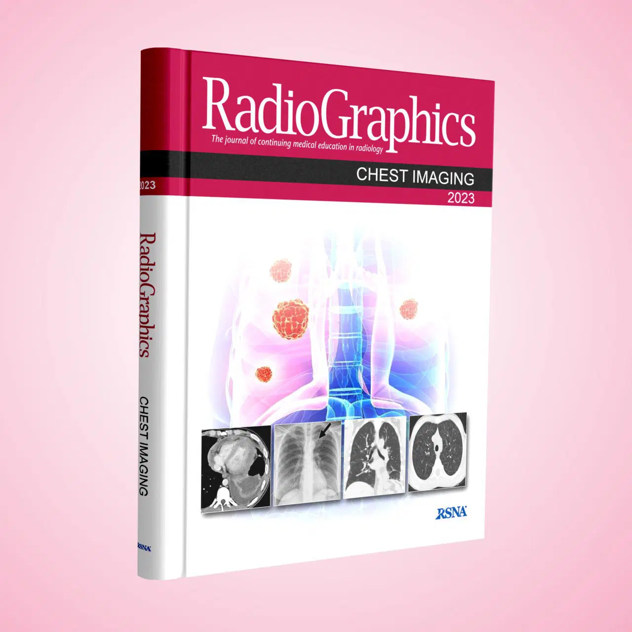 Radiographics Chest Imaging 2023