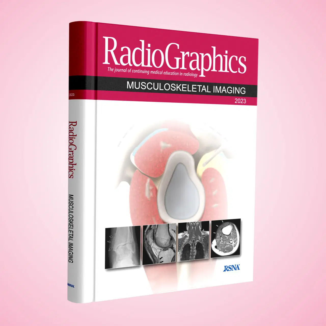 Radiographics Musculoskeletal Imaging 2023