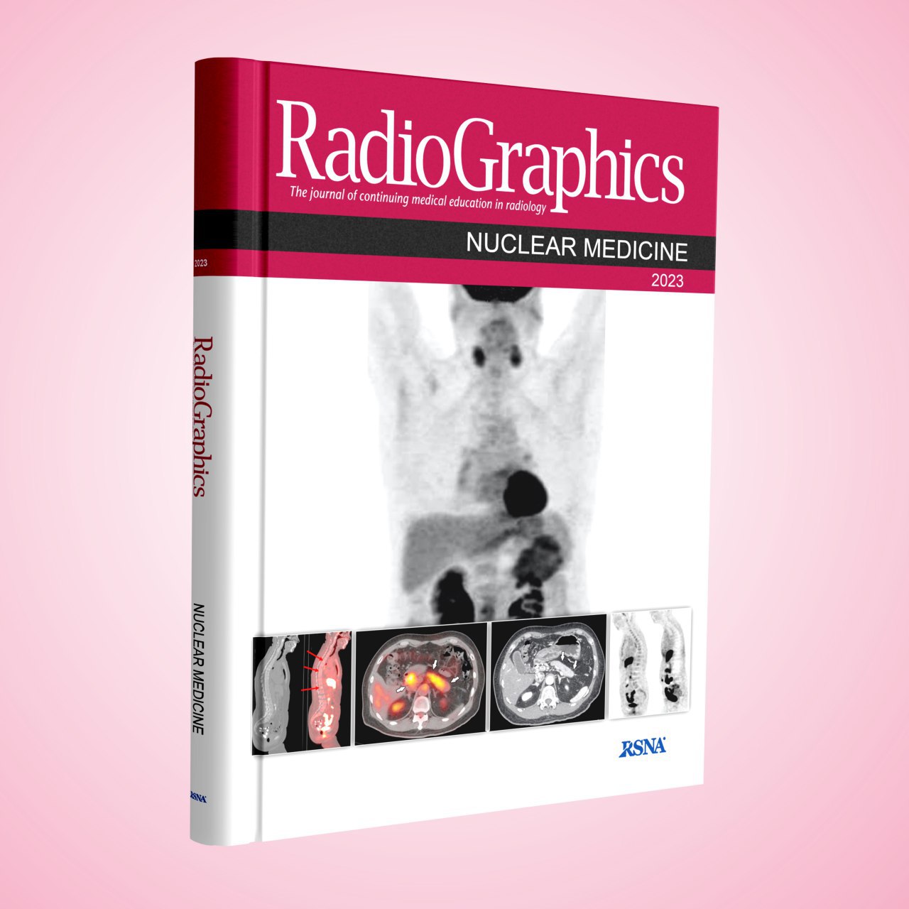 Radiographics NUCLEAR MEDICINE 2023 Contents 1: Anatomic and Functional Imaging of Immunoglobulin G4–related Disease and Its Mimics 2: 18F-Fluoroestradiol: Current Applications and Future Directions 3: FDG PET/CT–based Response Assessment in Malignancies 4: Radioisotope Safety: 12 Real-life Scenarios 5: Added Value of FDG PET/MRI in Gynecologic Oncology: A Pictorial Review 6: Hepatobiliary Scintigraphy: A Case-based Review