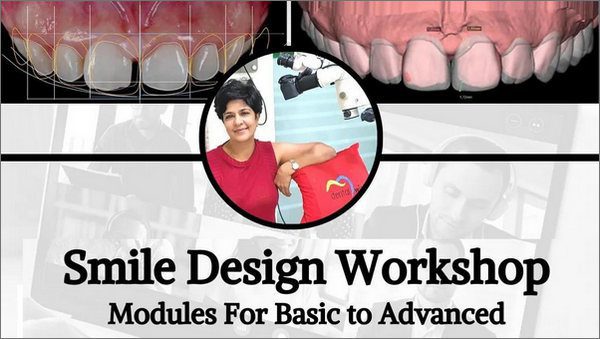 Smile Design Workshop, Modules for Basic to Advanced