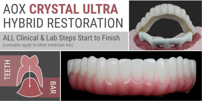 AOX Crystal Ultra Hybrid Restoration: All Clinical & Lab Steps Start to Finish