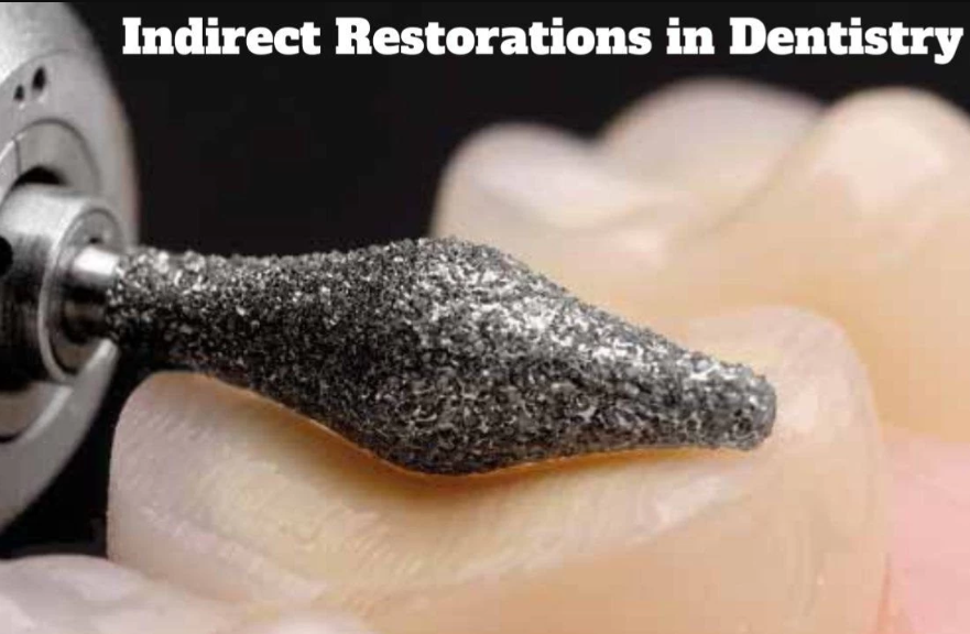 Indirect Restorations in Dentistry – A Complete Guide