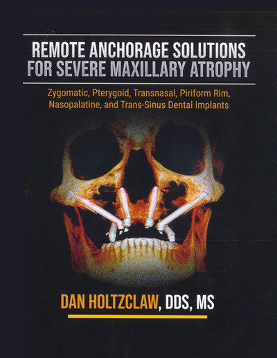 Remote Anchorage Solutions for Severe Maxillary Atrophy