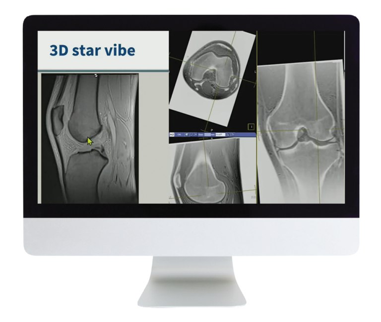 ARRS 3D MR Imaging of Joints with Arthroscopy Correlations 2023