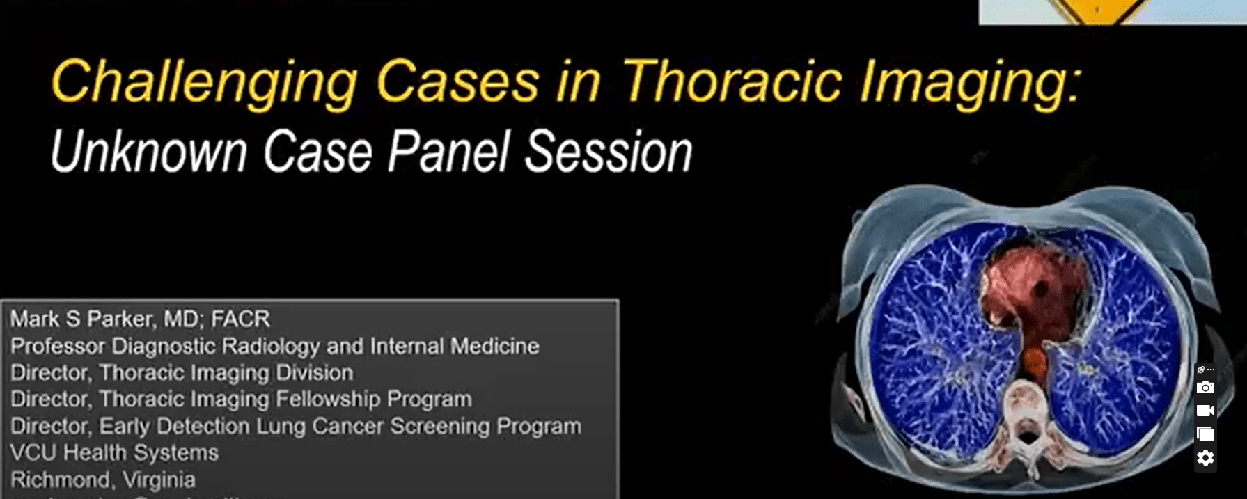 ARRS Challenging Cases in Thoracic Imaging 2024